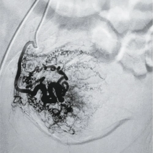 angiography system angiography system