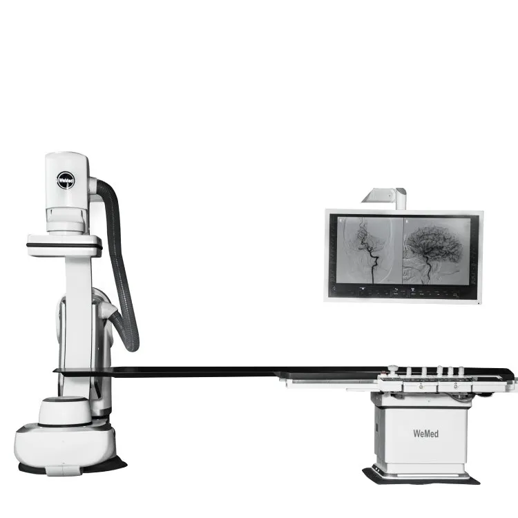 Sistem de angiografie digitală cu scădere